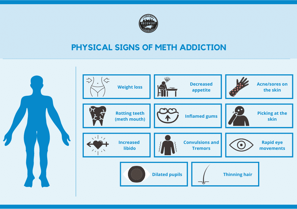 Physical signs of meth addiction