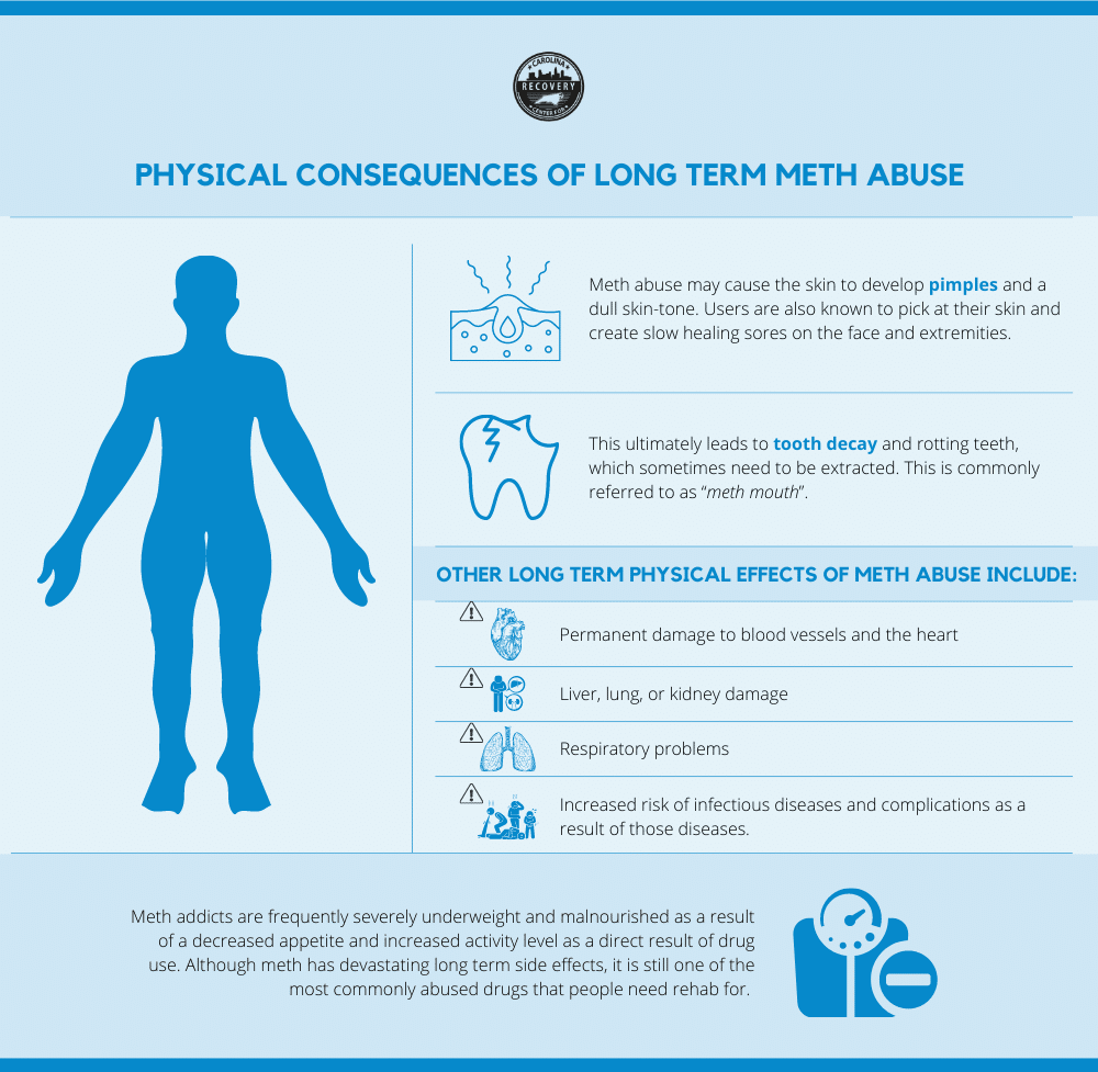 Physical Consequences Of Long Term Meth Abuse