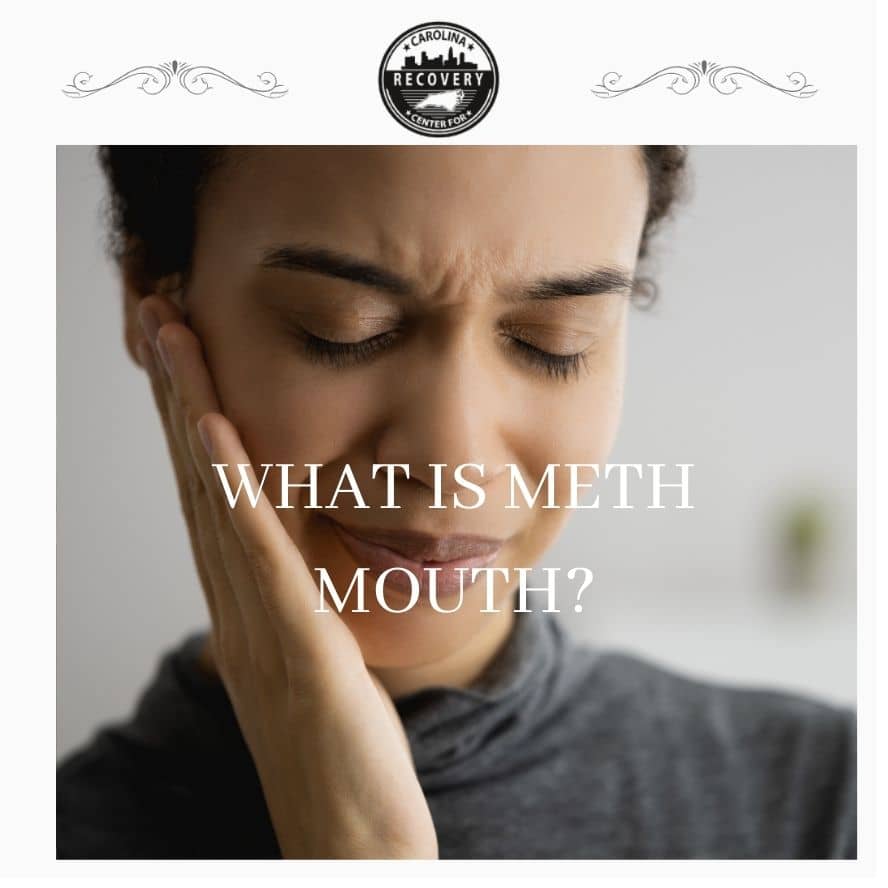 What is Meth Mouth? Understanding How Meth Affects Dental Health